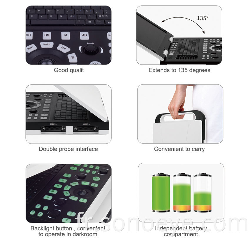 Portable Ultrasound Machine